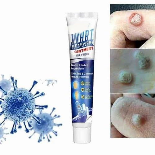 Wart Remover Gel Buy Get 199