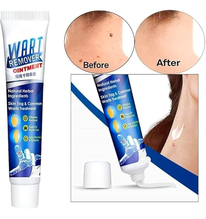 Wart Remover Gel Buy Get 199