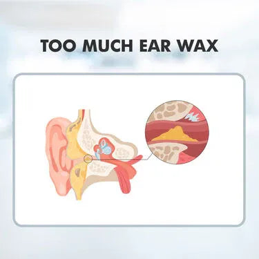 Hearing Starts Here Sound Increaser 499